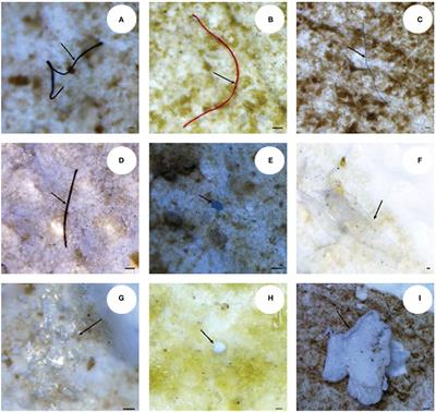 Micro and Nanoplastics Identification: Classic Methods and Innovative Detection Techniques